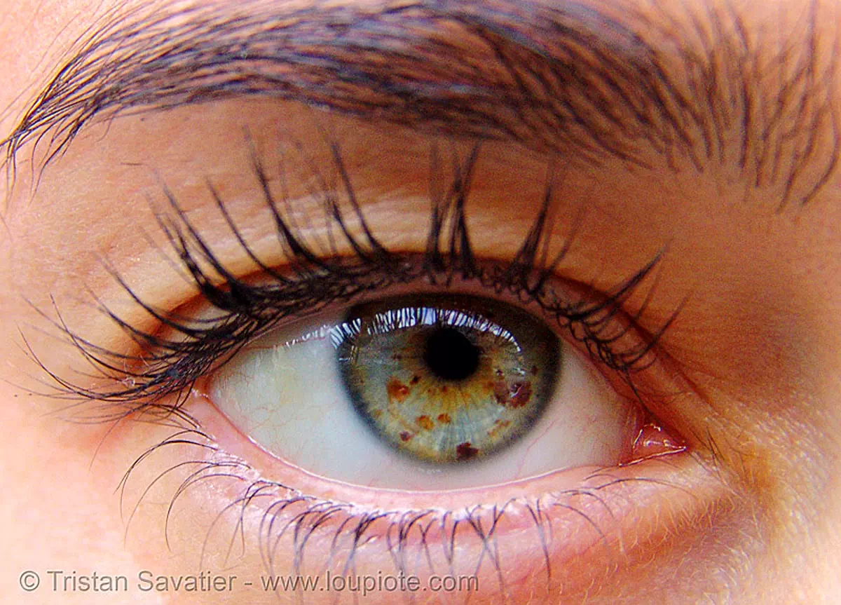  iris freckles, lucile, macro, pupil, right eye, spots, spotted, woman