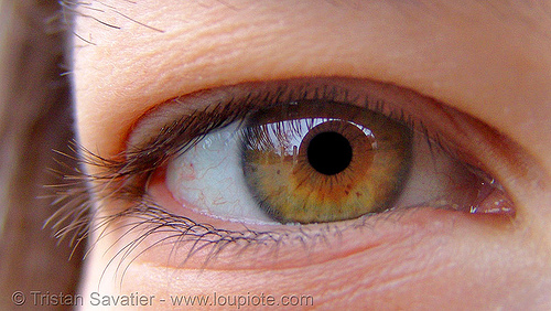 eye iris freckles