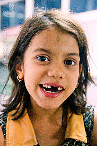 little girl with missing teeth - udaipur (india), baby teeth, child, kid, little girl, missing teeth, udaipur